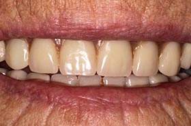 10-Letha-B-smile-a