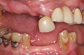 10-Letha-B-smile-b
